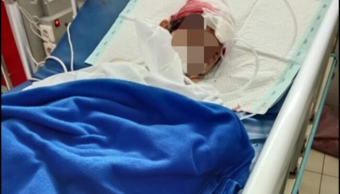 Tega !!! Jambret Lukai Anak Dibawah Umur Pakai Senjata Tajam Korban Tidak Sadarkan Diri